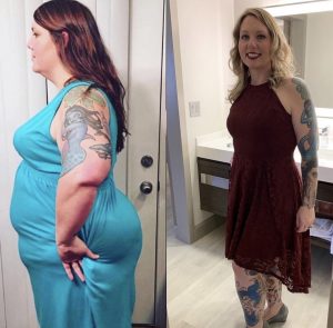 My Journey with VSG
